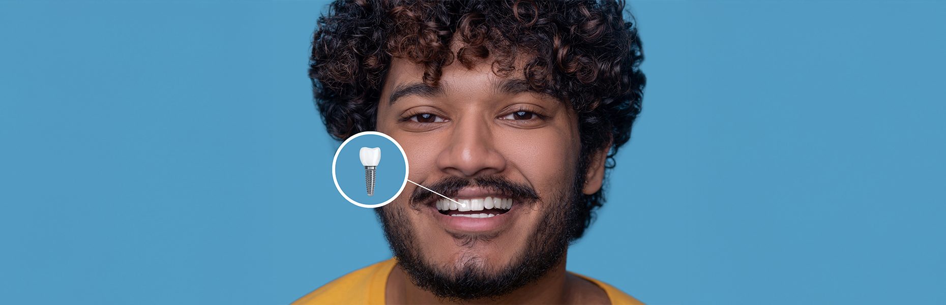 How Long Do Dental Implants Last?